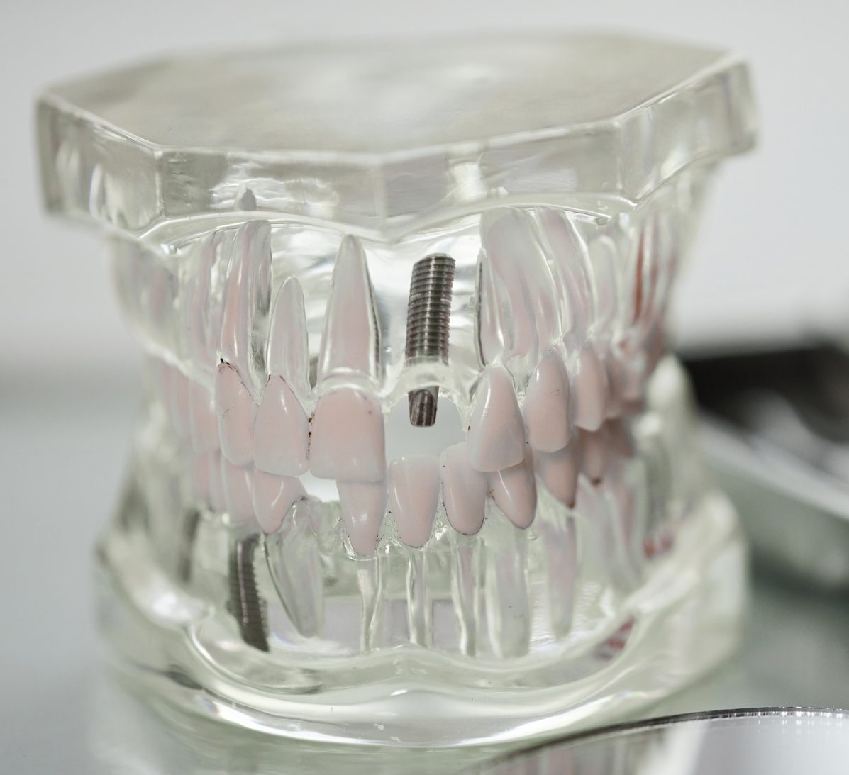 Closeup of clear tooth implantation model with set of tools in dental clinic